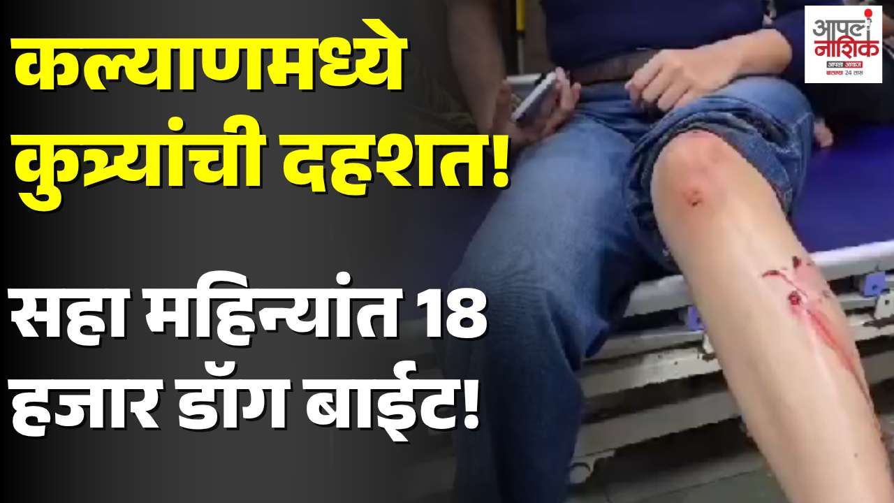 कल्याण-डोंबिवलीत भटक्या कुत्र्यांची दहशत; सहा महिन्यांत १८ हजार ४४७ डॉग बाईट